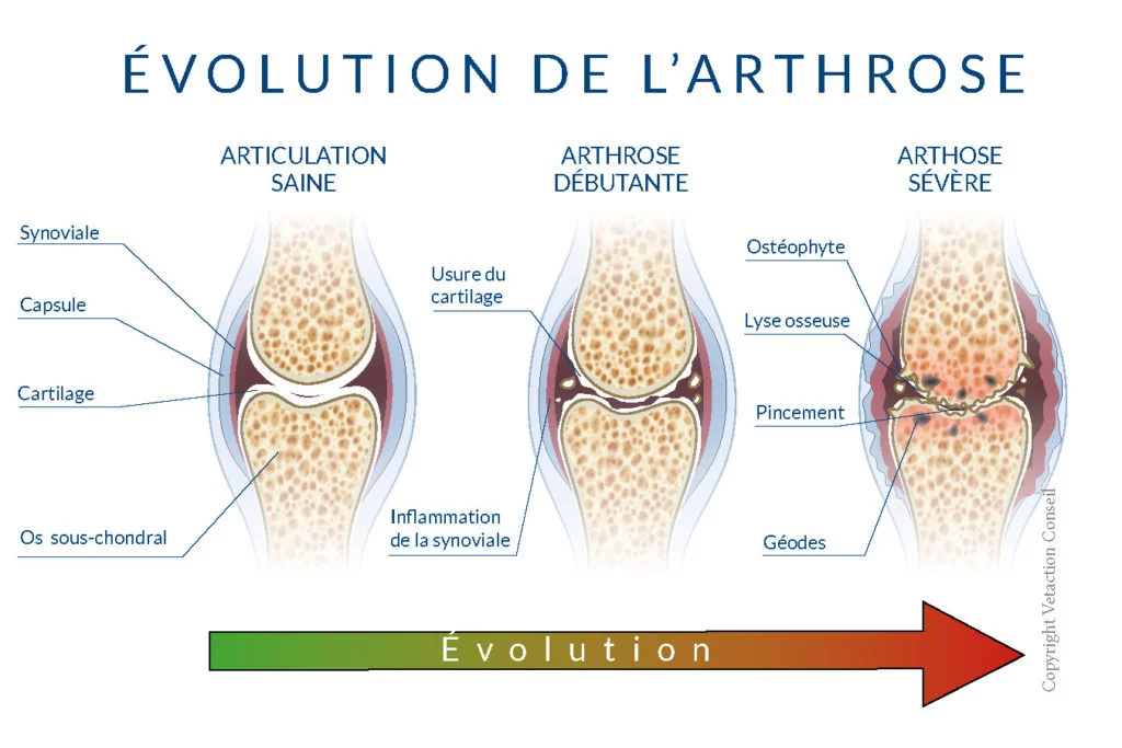 evolution arthrose chat evolution arthrose chat